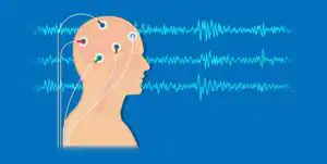 Biofeedback